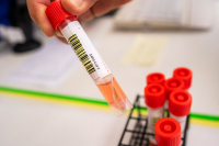 Det siste døgnet er det registrert 423 koronasmittede i Norge. Det er 44 færre enn samme dag i forrige uke. Trenden er fortsatt synkende.